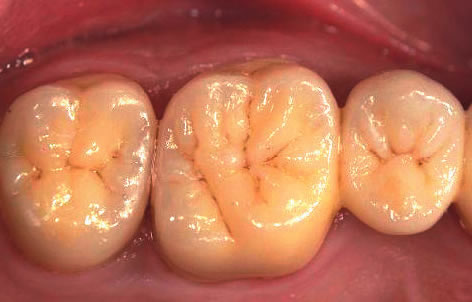 smile contouring ireland dromore co down
