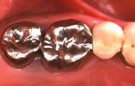 smile contouring northern ireland