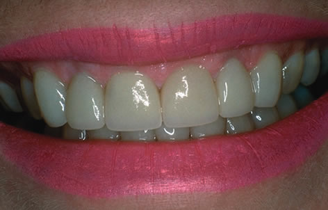 smile contouring ireland dromore co down