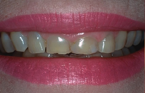 smile contouring northern ireland