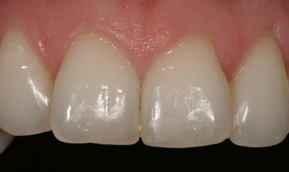 smile contouring ireland dromore co down