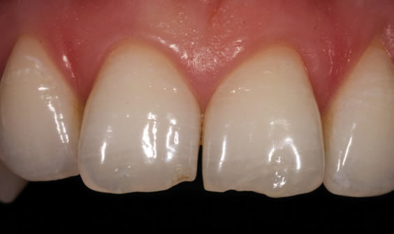 smile contouring northern ireland