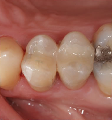 smile contouring ireland dromore co down