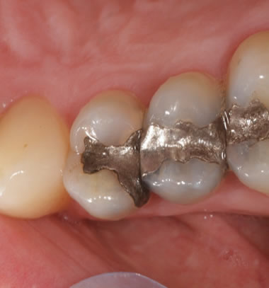 smile contouring northern ireland
