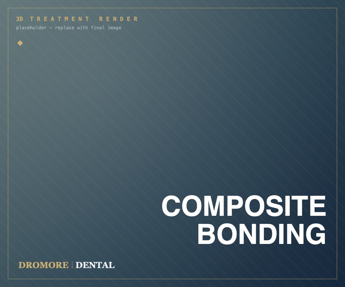 Composite Bonding